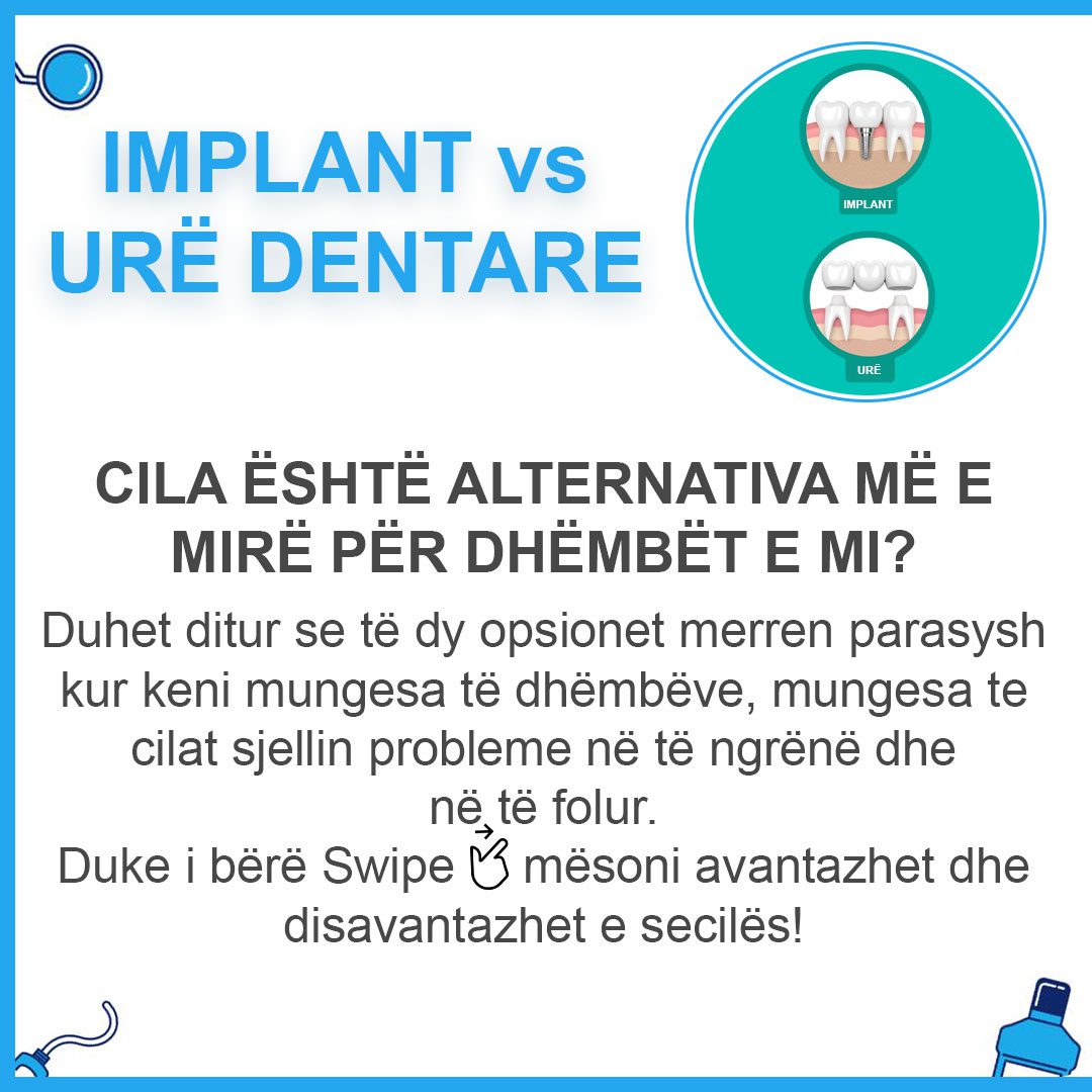 implant-vs-ure_01