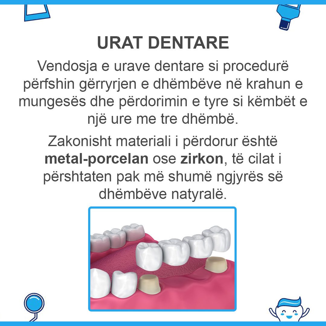 implant-vs-ure_02