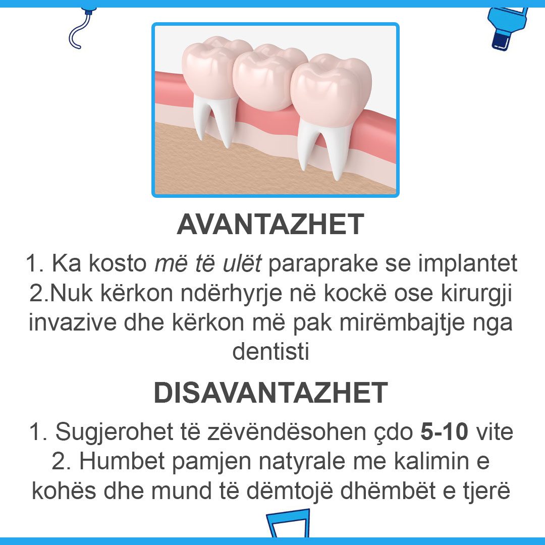implant-vs-ure_03